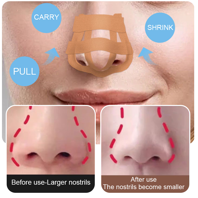 Beleza Nose Up Lifting Bridge  - Nose Trimmer avaliação e preço